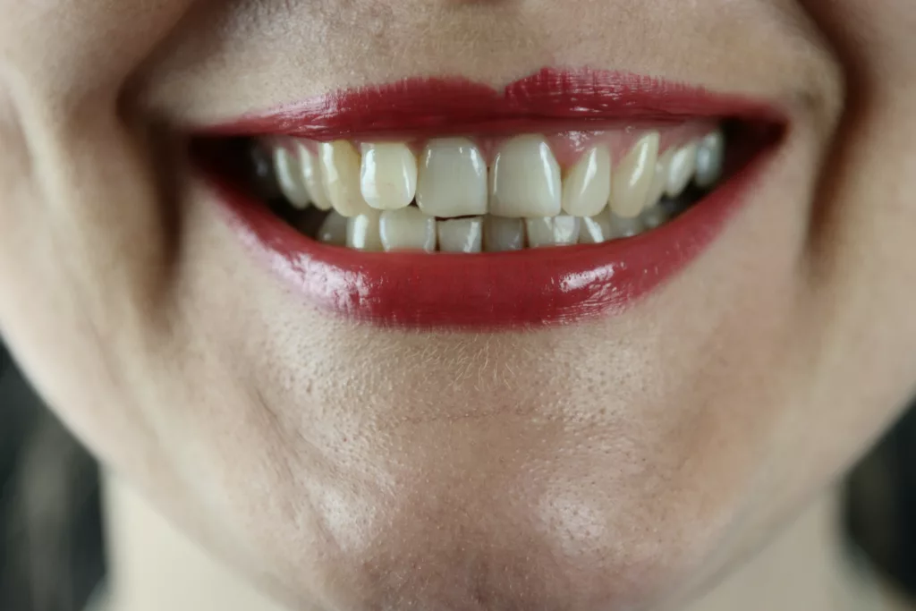 Does oil pulling whiten teeth?